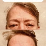 Фото №7 Массаж лица