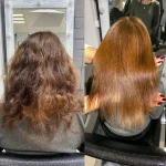 Нанопластика 