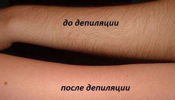 Фото Спа-шугаринг, сахарная эпиляция, шугаринг