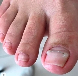 Фото Курс практик Титановая нить, 1 день