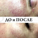 Требуется модель для Косметолога