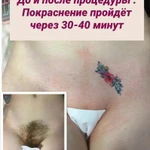 Шугаринг Пятигорск . Шугаринг в Пятигорске 