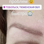 Фото №4 Удаление татуировок татуажа